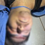 Arrojan cadáver a clínica