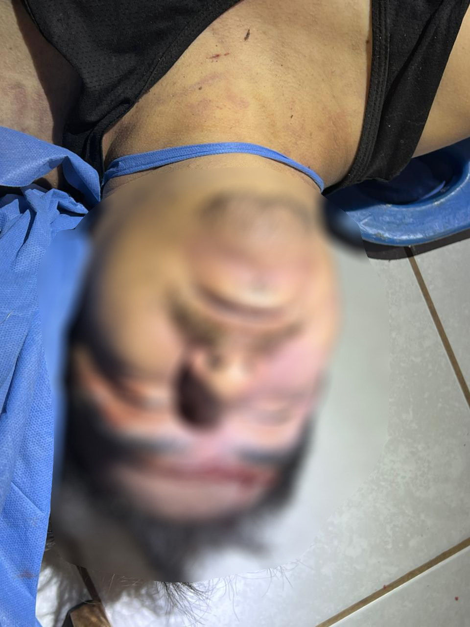 Arrojan cadáver a clínica