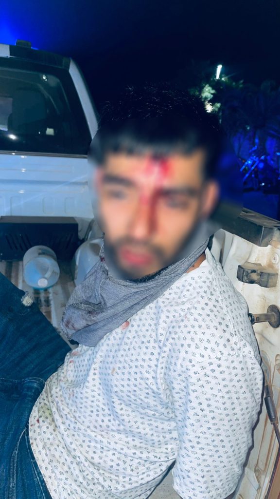 Le pega un individuo botellazo a una mujer